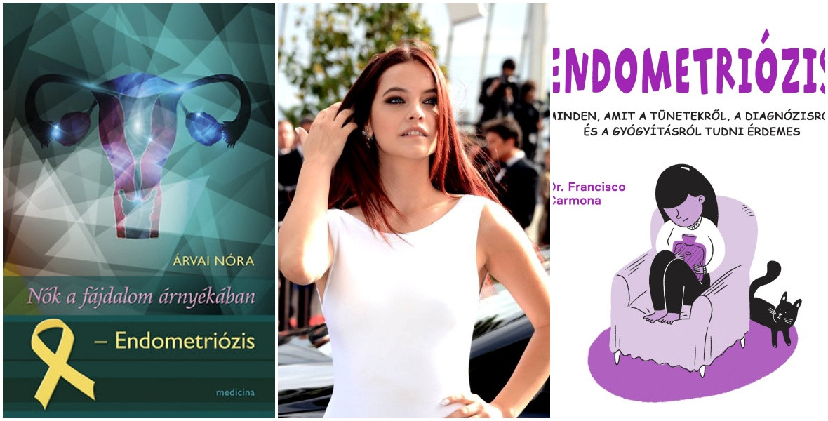 „Ezzel küzdök. Szar ügy. Beszéljünk róla!” – 3 könyv az endometriózisról